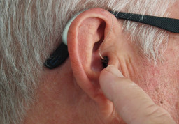 image of Noise induced hearing loss